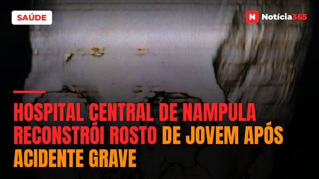 Hospital central de Nampula reconstrói rosto de jovem após acidente grave